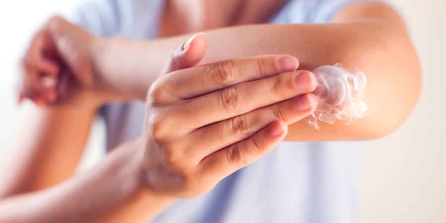 application crème apaiser eczéma